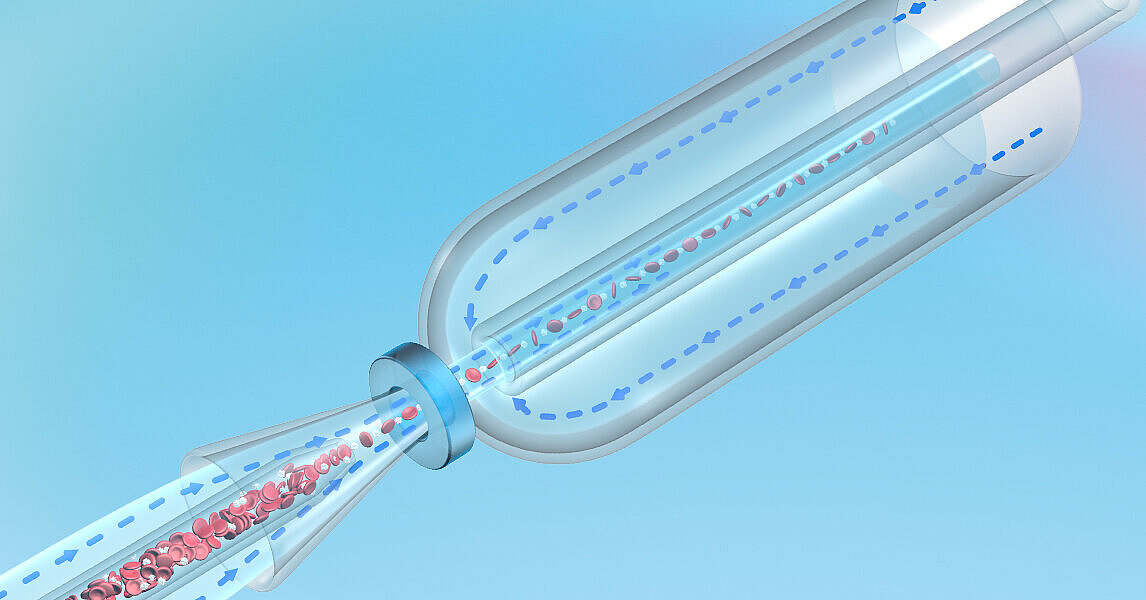 Impédance et Focalisation hydrodynamique